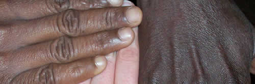 Bazterketa arriskuan dauden pertsonei laguntza.